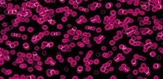 990101 Bacteria